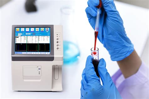 what are the different types of blood gas analyzers|Blood Gas Analyzers: Overview, Functions, Types, .